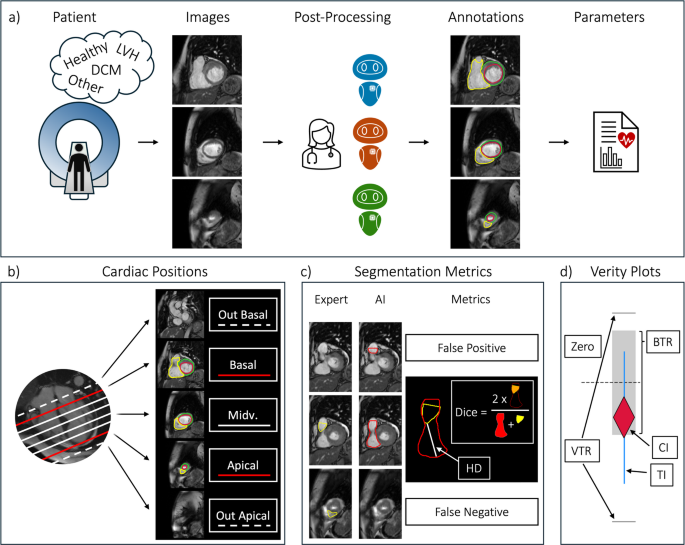 A comparison of vendor artificial intelligence solutions for automated post-processing of short