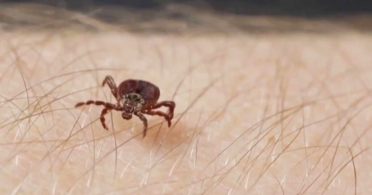 ‘My fingers were purple’: Tick