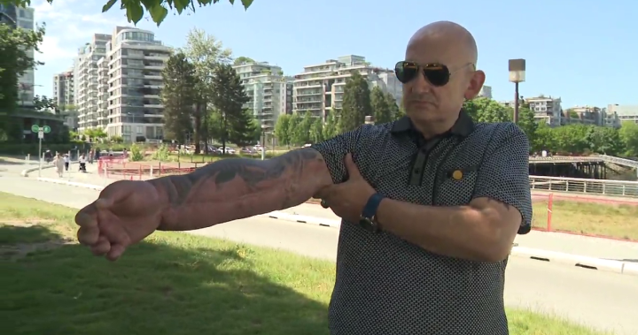 B.C. man still waiting for compensation from COVID vaccine injury