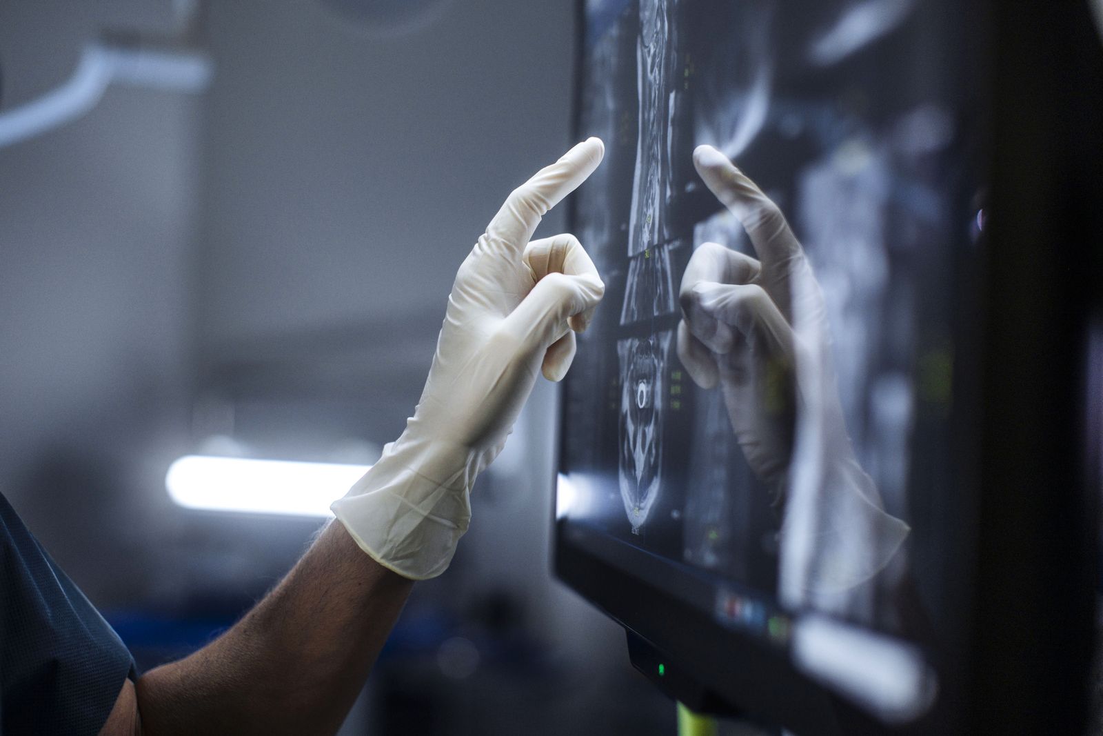 How A.I. Will Reshape Radiology