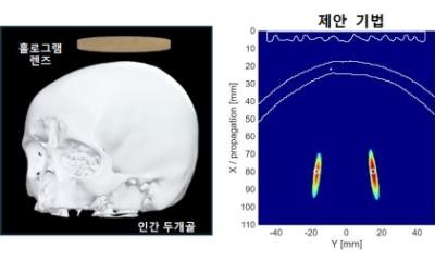 AI-based hologram technology to advance multi-focal brain stimulation - healthcare
