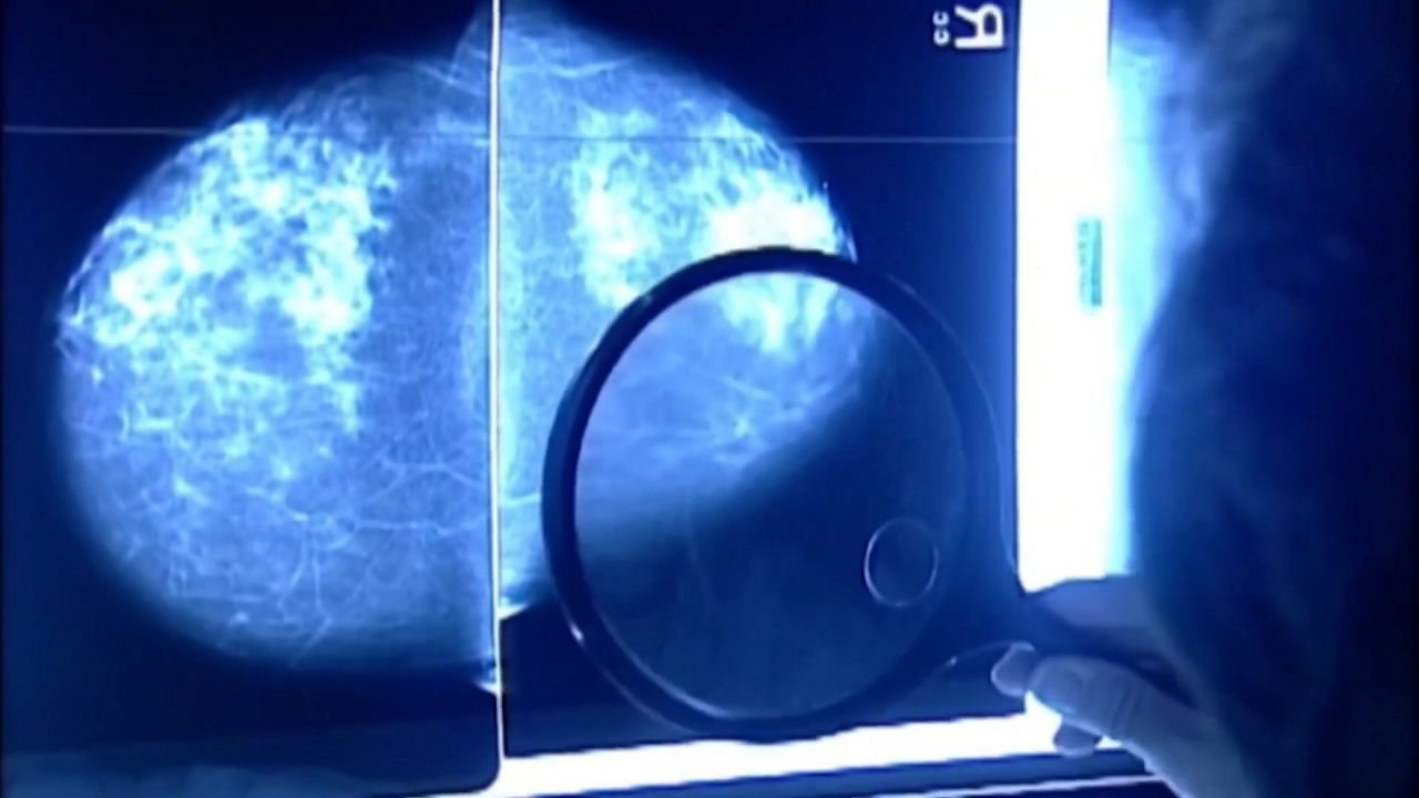 Preclinical study shows technology could slow aggressive breast cancer