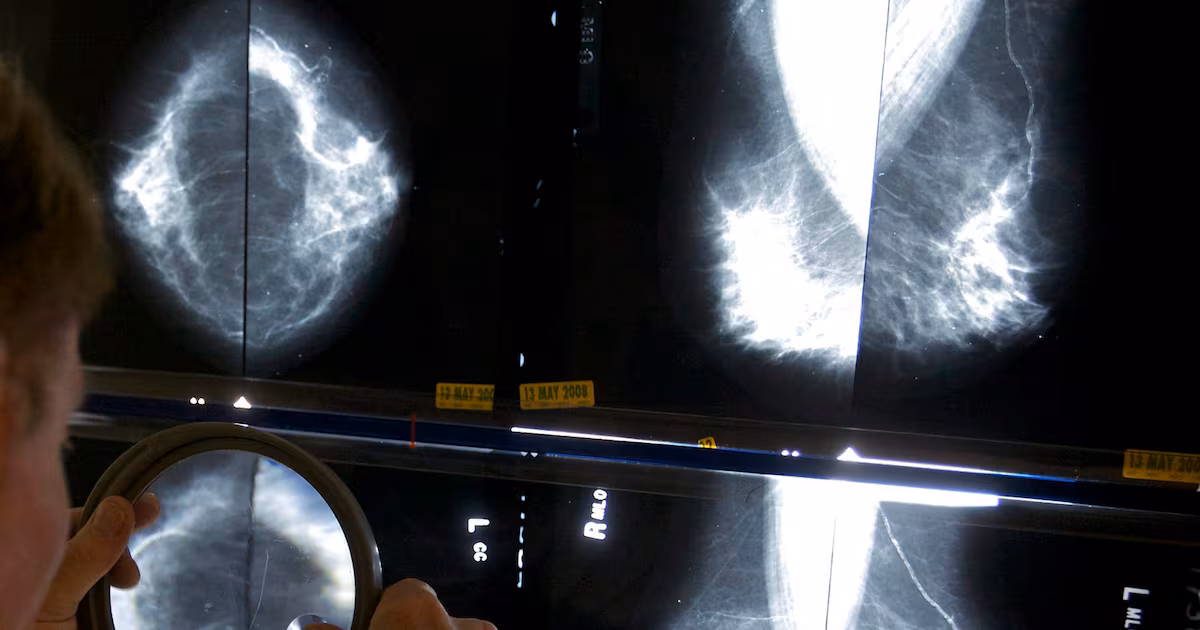 Health Canada approves drug that treats hot flashes for use by breast cancer patients