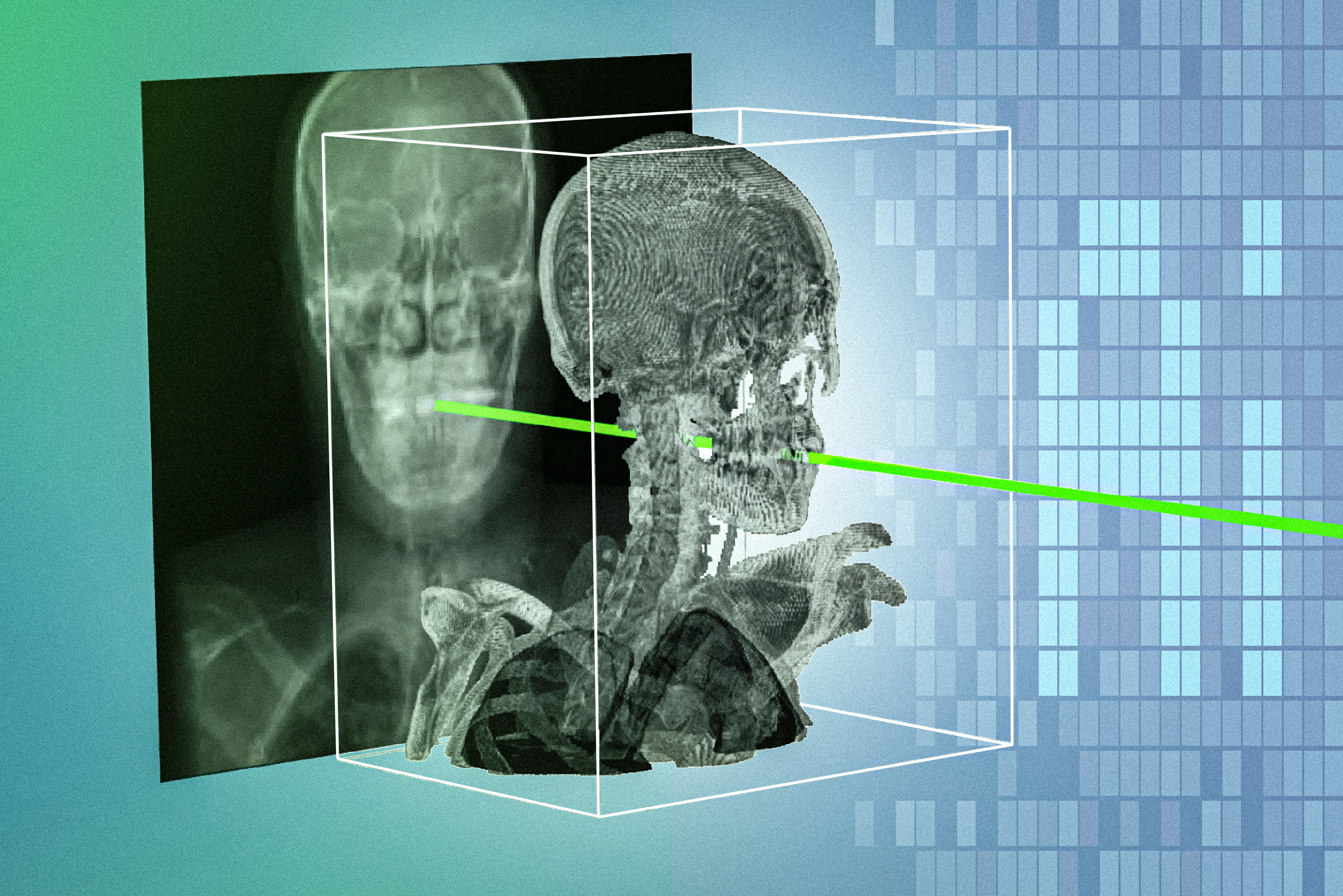 New AI technique could make minimally invasive surgeries safer and more precise
