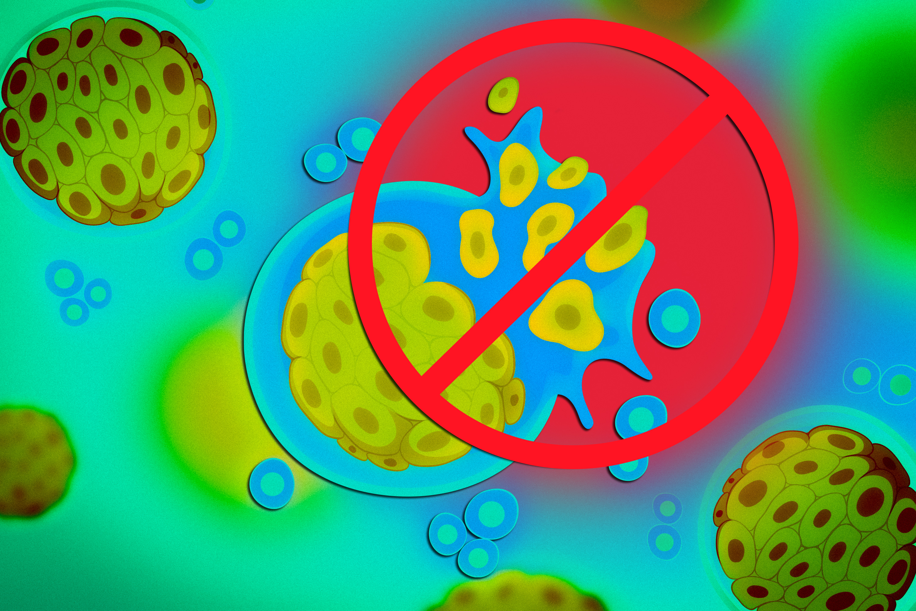 Biologists identify a cellular pathway that allows colorectal cancer to metastasize