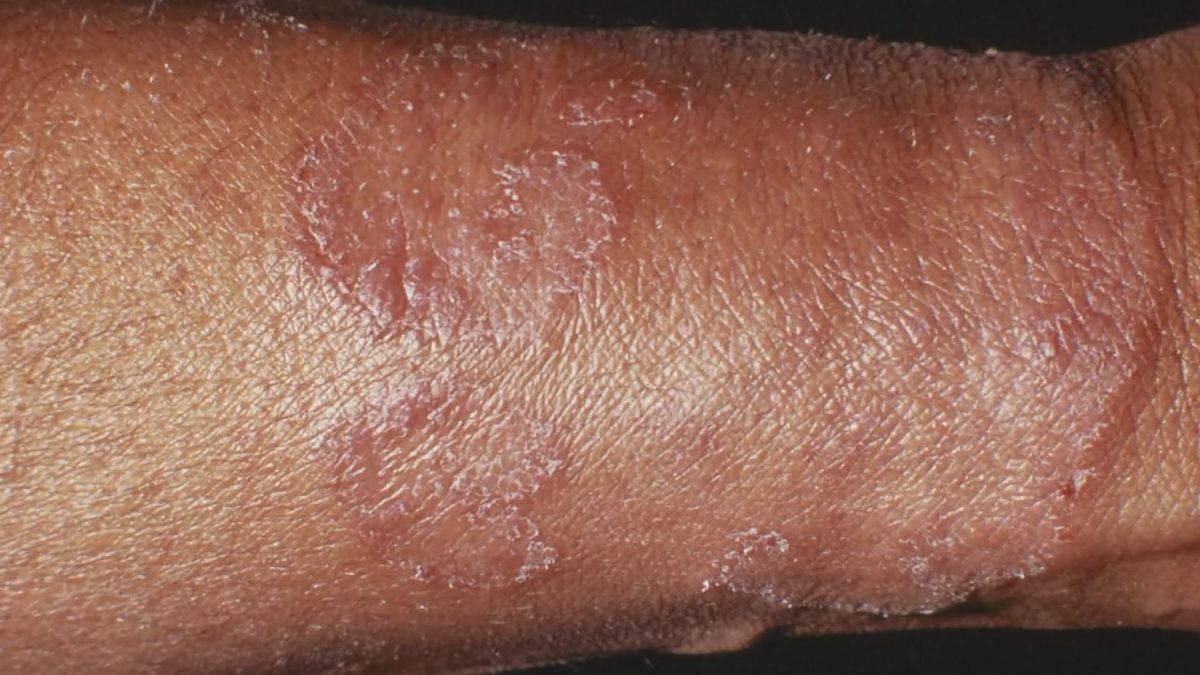 Fall skin care: when to see a doctor?