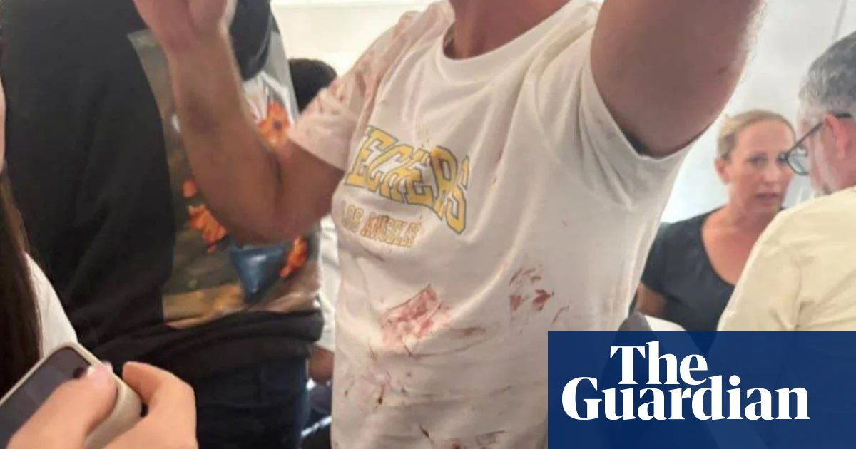 Pilot on Israel-bound plane stabbed co