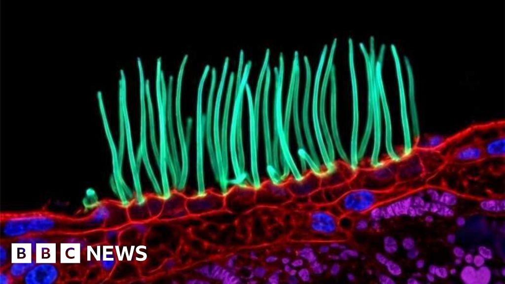 Prize-winning image which sparked backlash was AI